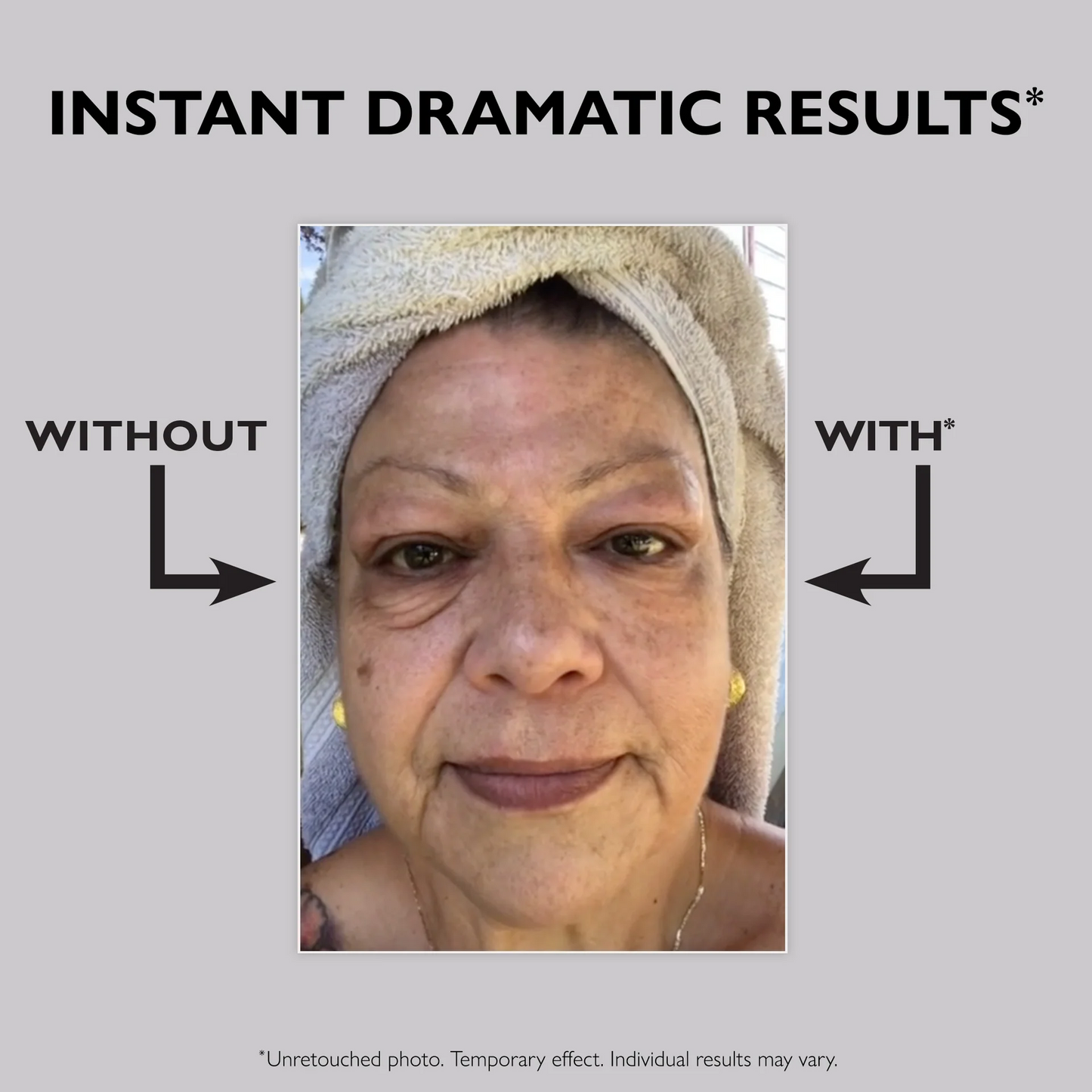 INSTANT FIRMX EYE TEMPORARY EYE TIGHTENER